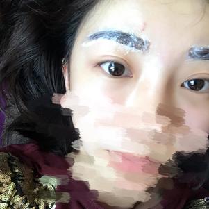 大同清木整形醫(yī)院張樹霞醫(yī)生做半永久紋眉效果如何？附半永久紋眉效果圖