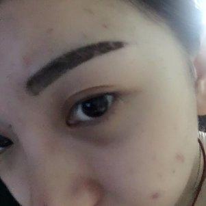 大同清木整形醫(yī)院張樹霞醫(yī)生做半永久紋眉效果如何？附半永久紋眉效果圖