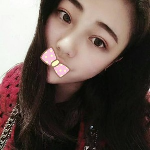 張家口維多利亞整形醫(yī)院張凱醫(yī)生做全切雙眼皮真實(shí)案例效果對比圖