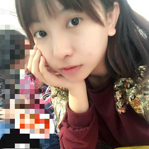 大同清木整形醫(yī)院張樹霞醫(yī)生做半永久紋眉效果如何？附半永久紋眉效果圖