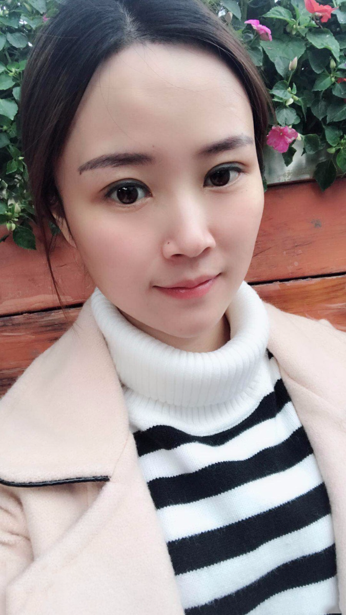 廣東韓妃醫(yī)療美容醫(yī)院做切開雙眼怎么樣？附案例效果圖
