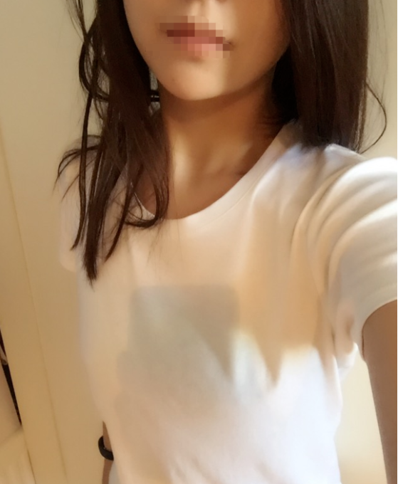 東莞韓美整形醫(yī)院醫(yī)生黃玉潔做假體隆胸怎么樣？附案例效果圖