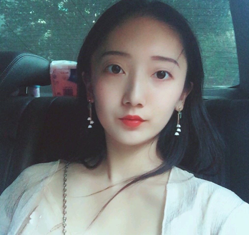 深圳鵬愛醫(yī)療美容醫(yī)院醫(yī)生文炯軫做埋線隆鼻怎么樣？附案例