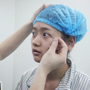 武漢伽美醫(yī)療美容醫(yī)院醫(yī)生鄭泰成做切開雙眼皮怎么樣？附案例