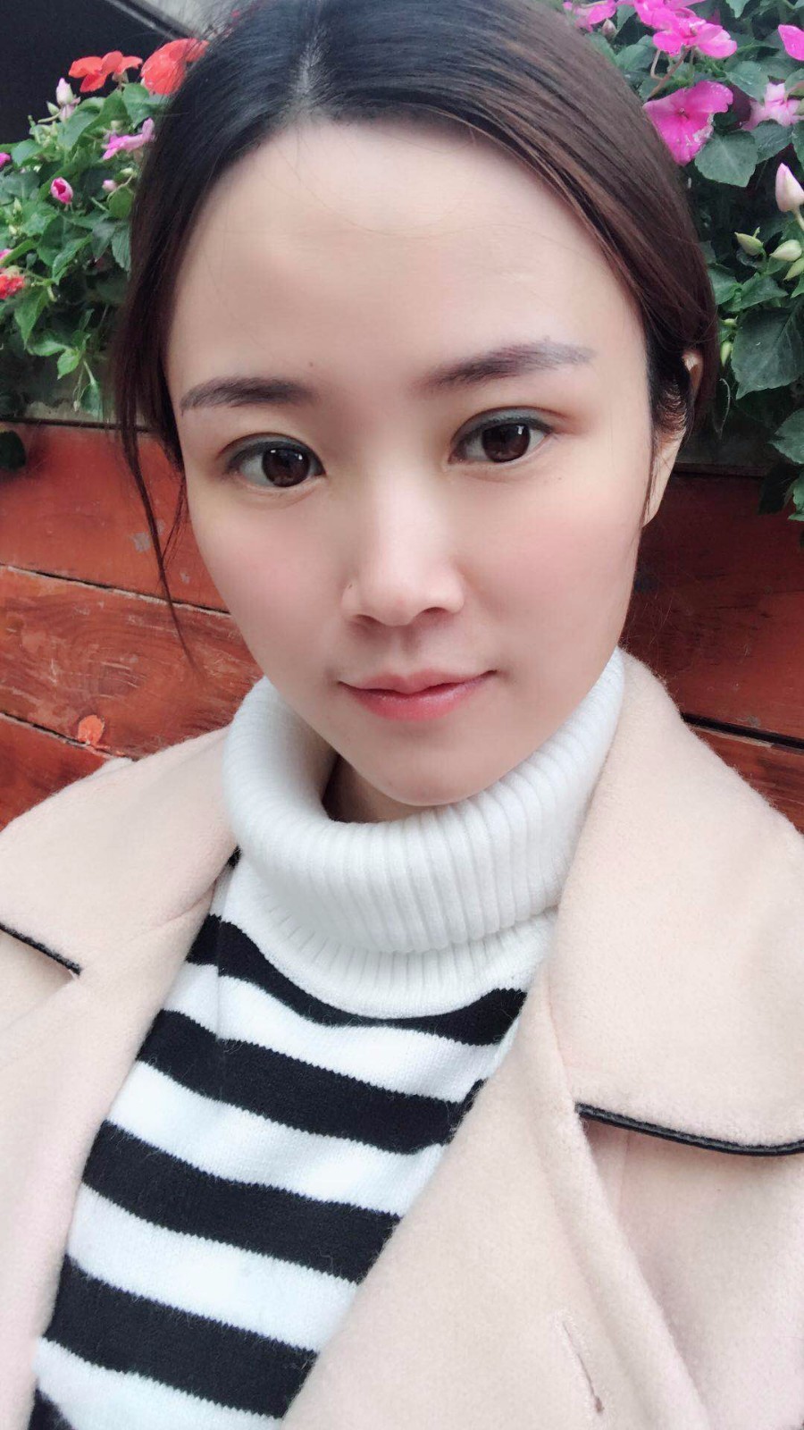 廣東韓妃醫(yī)療美容醫(yī)院做切開雙眼怎么樣？附案例效果圖