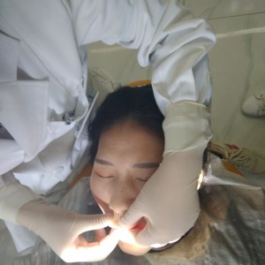 黔西南興義京州口腔醫(yī)院醫(yī)生徐勇做牙貼面怎么樣？附案例效果對比圖