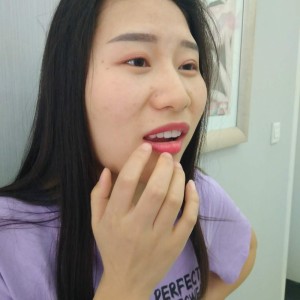 洛陽友好口腔醫(yī)院醫(yī)生李新然做牙貼面怎么樣？附案例效果圖