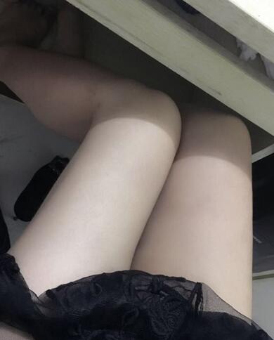 上海保加醫(yī)療美容門(mén)診部做大腿吸脂怎么樣？附楊勇醫(yī)生案例效果對(duì)比圖