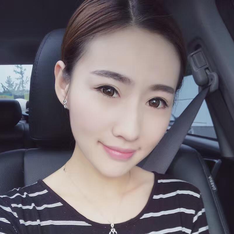 貴陽美和諧醫(yī)療整形醫(yī)生孫澤芳做切開雙眼皮效果怎么樣？附案例效果對(duì)比圖