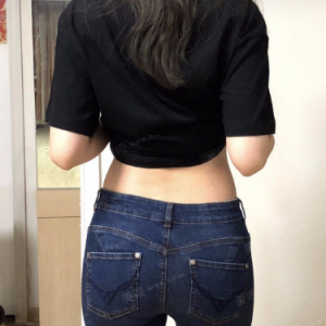 北京可思美整形醫(yī)院醫(yī)生斯勤做腰腹吸脂怎么樣？附案例效果對(duì)比圖