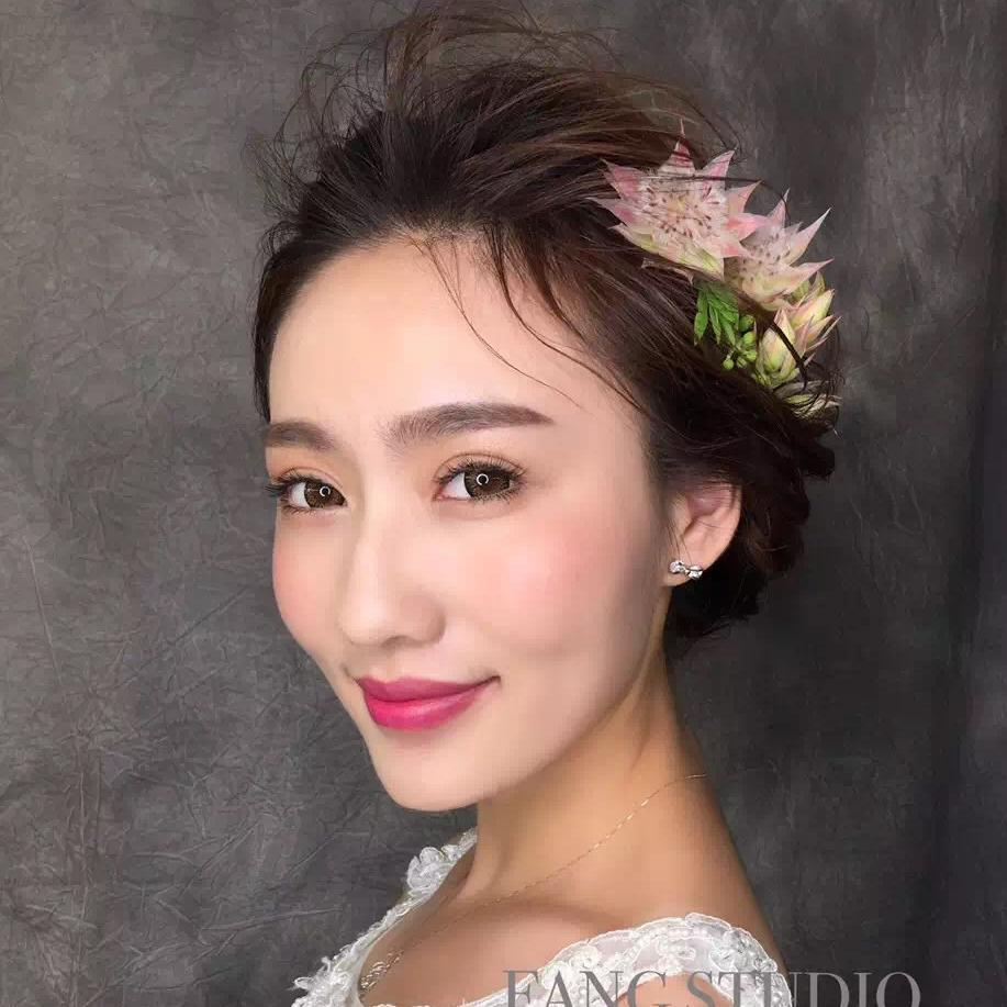 貴陽美和諧醫(yī)療整形醫(yī)生孫澤芳做切開雙眼皮效果怎么樣？附案例效果對比圖
