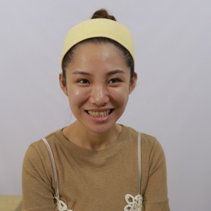 保定東陽口腔醫(yī)院醫(yī)生白小青做牙齒冷光美白怎么樣？附案例效果對比圖