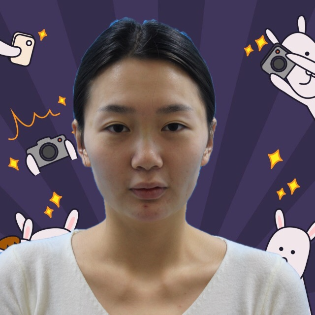 杭州格萊美整形美容醫(yī)院醫(yī)生張霞飛做自體脂肪全臉填充效果怎么樣？