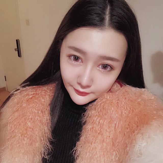 杭州格萊美整形美容醫(yī)院醫(yī)生張霞飛做自體脂肪全臉填充效果怎么樣？