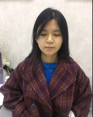 上海時(shí)光整形外科醫(yī)院醫(yī)生何晉龍做假體隆胸怎么樣？附案例效果對(duì)比圖