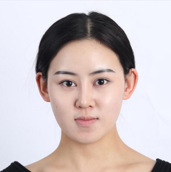上海時(shí)光整形外科醫(yī)院醫(yī)生李靜林做假體隆鼻和反頜手術(shù)怎么樣？