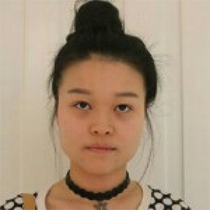 鄭州管城中醫(yī)院整形美容中心醫(yī)生張秀英做注射瘦臉怎么樣？附除皺瘦臉案例效果圖