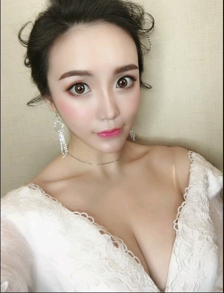 重慶當代整形美容醫(yī)院醫(yī)生楊健做假體隆胸怎么樣？附案例