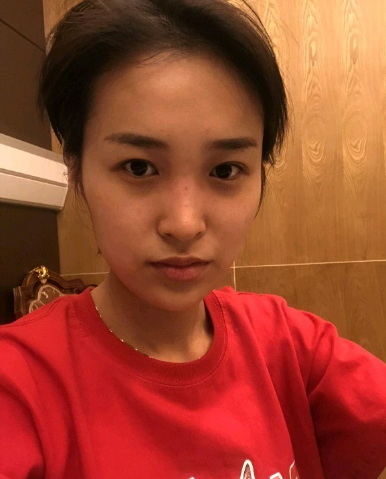 武漢米蘭醫(yī)療美容醫(yī)生柳再億做眼綜合+鼻綜合整形怎么樣？附真實(shí)案例對(duì)比圖