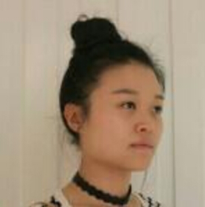 鄭州管城中醫(yī)院整形美容中心醫(yī)生張秀英做注射瘦臉怎么樣？附除皺瘦臉案例效果圖