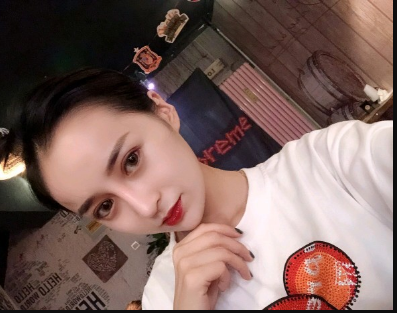 武漢米蘭醫(yī)療美容醫(yī)生柳再億做眼綜合+鼻綜合整形怎么樣？附真實(shí)案例對(duì)比圖