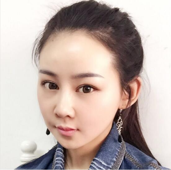 上海時(shí)光整形外科醫(yī)院醫(yī)生李靜林做假體隆鼻和反頜手術(shù)怎么樣？