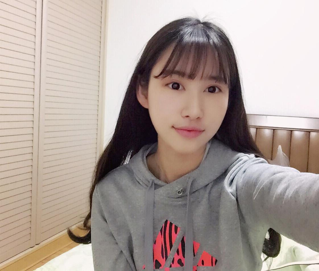 海南華美醫(yī)學(xué)美容醫(yī)院醫(yī)生潘磊做顴骨顴弓整形怎么樣？附案例效果對(duì)比圖