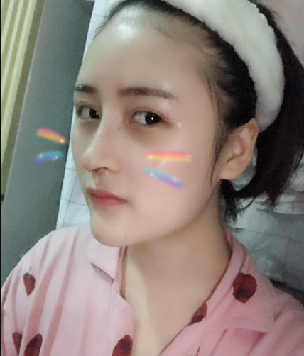 北京伊美爾美容愛康醫(yī)院醫(yī)生柳成做鼻綜合整形怎么樣？附案例效果圖
