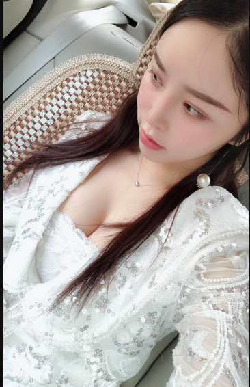 吉林現(xiàn)代整形美容醫(yī)院做假體隆胸效果怎么樣？附醫(yī)院案例效果對(duì)比圖