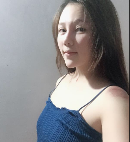 北京東方和諧醫(yī)療整形診所馮斌醫(yī)生做假體隆胸怎么樣？附案例效果對比圖