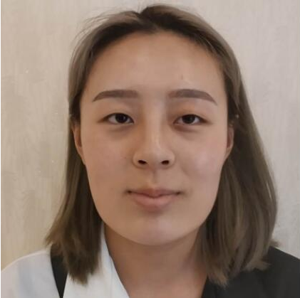 上海時(shí)光整形醫(yī)院做雙眼皮怎么樣？附石重明醫(yī)生雙眼皮+隆鼻+下頜角磨骨案例效果對(duì)比圖