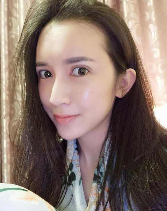 上海時(shí)光整形醫(yī)院張晶醫(yī)生做開眼角怎么樣？附真實(shí)效果圖
