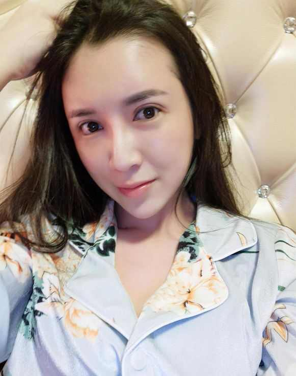 上海時(shí)光整形醫(yī)院張晶醫(yī)生做開眼角怎么樣？附真實(shí)效果圖