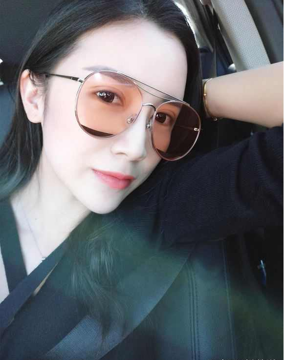 上海時光整形醫(yī)院張晶醫(yī)生做開眼角怎么樣？附真實效果圖