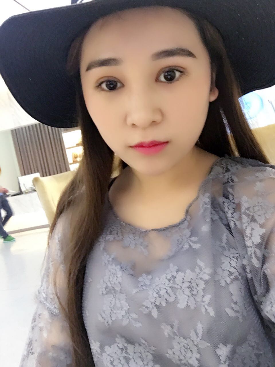 蚌埠韓美美萊整形醫(yī)生鄭捷做開眼角怎么樣？附案例效果圖