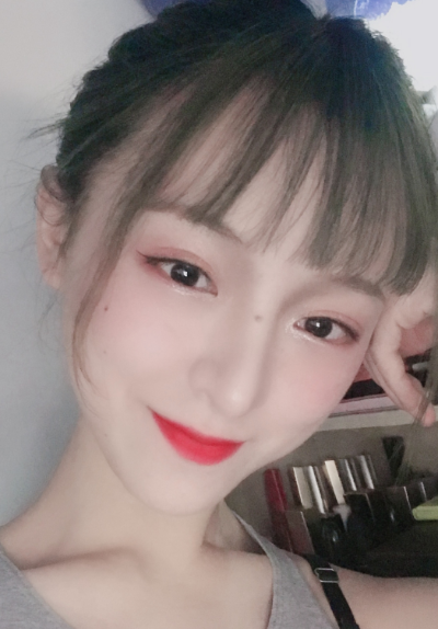 周娜醫(yī)生縮鼻頭案例效果圖