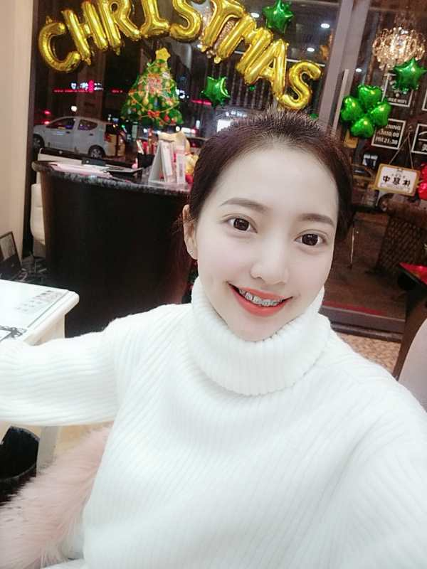 巴中華醫(yī)口腔醫(yī)院做牙齒矯正效果好嗎？附母汶靈醫(yī)生牙齒矯正案例效果圖