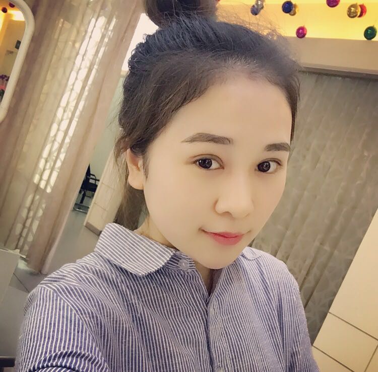 蚌埠韓美美萊整形醫(yī)生鄭捷做開眼角怎么樣？附案例效果圖
