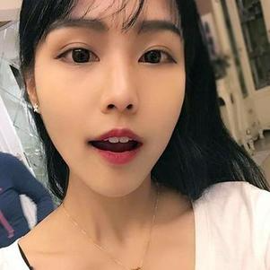 鞍山時(shí)代口腔門診部洗牙效果怎么樣？附申元休醫(yī)生洗牙案例效果圖