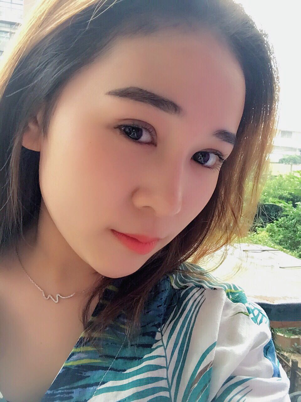 蚌埠韓美美萊整形醫(yī)生鄭捷做開眼角怎么樣？附案例效果圖