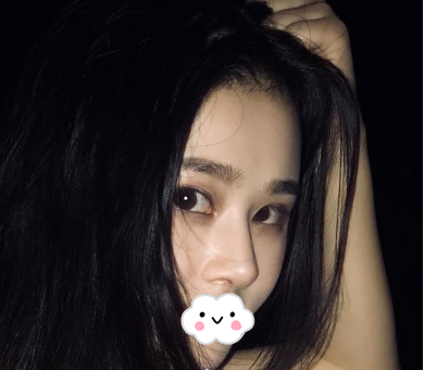 蚌埠韓美美萊整形醫(yī)生歷芳做耳軟骨隆鼻怎么樣？附耳軟骨隆鼻案例對(duì)比圖
