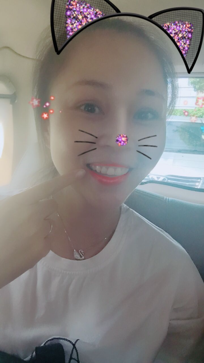保定東陽口腔醫(yī)院趙星醫(yī)生做牙齒瓷貼面怎么樣？附牙齒瓷貼面案例效果對比圖