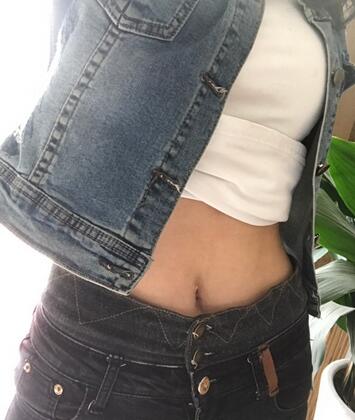 保定現(xiàn)代女子醫(yī)院整形美容中心做腰腹部吸脂怎么樣？附林秀蓮醫(yī)生案例效果圖