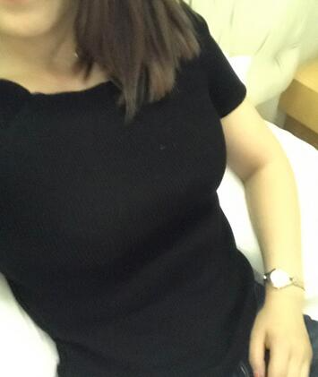 保定現(xiàn)代女子醫(yī)院整形美容中心做腰腹部吸脂怎么樣？附林秀蓮醫(yī)生案例效果圖
