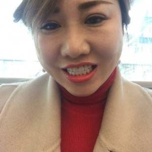 保定東陽(yáng)口腔醫(yī)院趙晨醫(yī)生做瓷貼面怎么樣？附瓷貼面案例效果對(duì)比圖