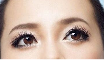 激光去黑眼圈多少錢？激光去黑眼圈效果好嗎？