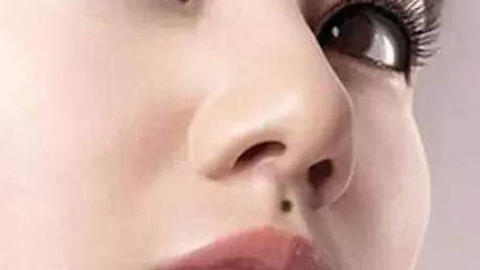 綜合隆鼻價(jià)格需要多少錢？?jī)r(jià)格貴嗎？
