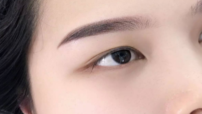 下眼瞼手術(shù)要多久時(shí)間恢復(fù)？一般需要多少錢？