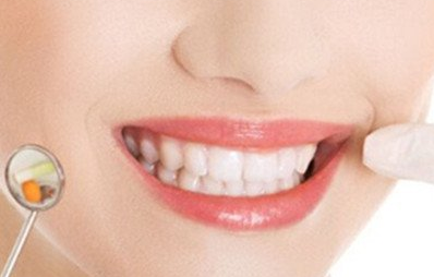合金烤瓷牙多少錢(qián)一個(gè)？?jī)r(jià)錢(qián)貴不貴？