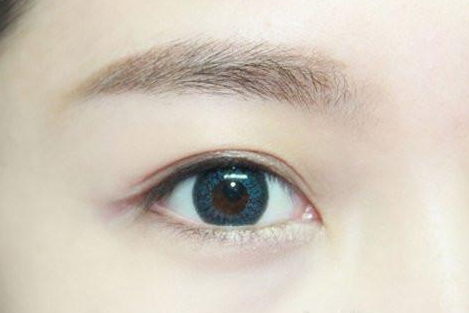 定點(diǎn)雙眼皮做一次需要多少錢？定點(diǎn)雙眼皮手術(shù)有哪些優(yōu)勢(shì)？